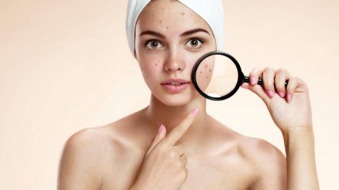 Modern and effective ways to treat acne and post-acne