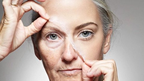 Wrinkles Try anti wrinkle smoothing injections