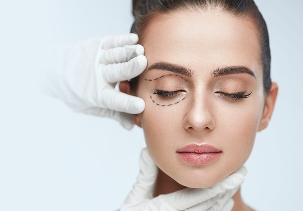 Blepharoplasty: When Is Eyelid Surgery Really the Right Solution?