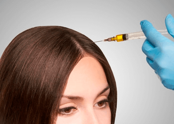 MESOTHERAPY HAIR LOSS TREATMENT