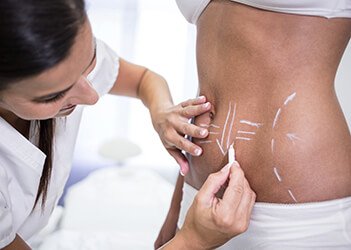 Cellulite removal. Mesotherapy cellulite treatment